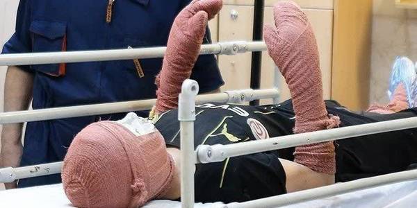 انفجار نارنجک چهارشنبه سوری در دستان نوجوان 13 ساله و قطعی سه انگشت وی